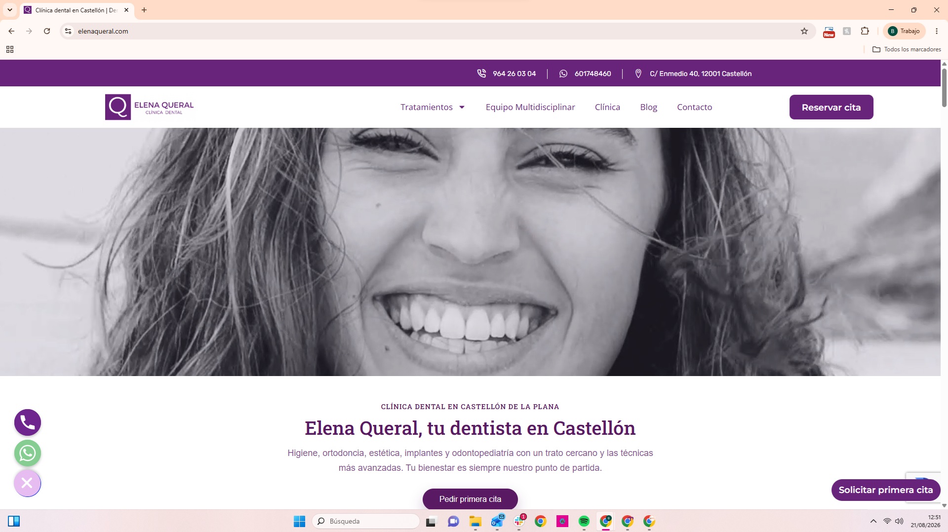 Mujer sonriendo con dientes blancos y perfectos en clínica dental Elena Queral Castellón